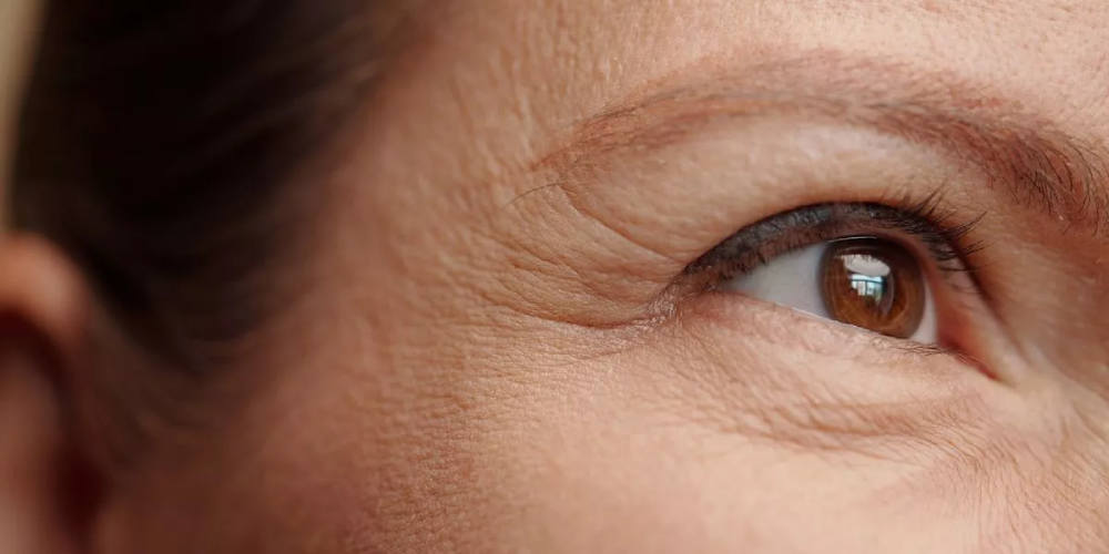laser-eye-wrinkle-reductio-blog