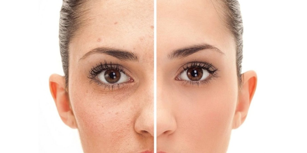 different-types-of-skin-blemishes-separet-page